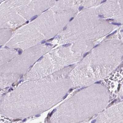 Immunohistochemistry-Paraffin: CLIC4 Antibody [NBP2-49321] - Staining of human skeletal muscle using Anti-CLIC4 antibody NBP2-49321.