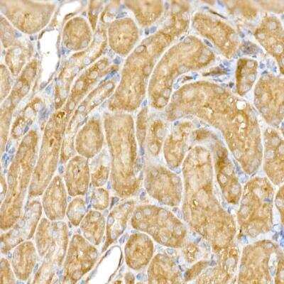 Immunohistochemistry-Paraffin: CLIC4 Antibody [NBP2-92908] - Mouse kidney using CLIC4 Rabbit pAb  dilution of 1:50 (40x lens).Perform high pressure antigen retrieval with 10 mM citrate buffer pH 6.0 before commencing with IHC staining protocol.