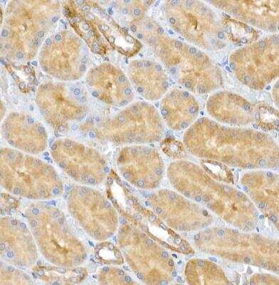 Immunohistochemistry-Paraffin: CLIC4 Antibody [NBP2-92908] - Rat kidney using CLIC4 Rabbit pAb at dilution of 1:50 (40x lens).Perform high pressure antigen retrieval with 10 mM citrate buffer pH 6.0 before commencing with IHC staining protocol.