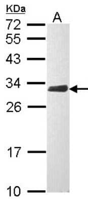 Western Blot: CLIC4 Antibody [NBP1-33474] - Sample (30 ug of whole cell lysate) A: Raji 12% SDS PAGE; antibody diluted at 1:1000.