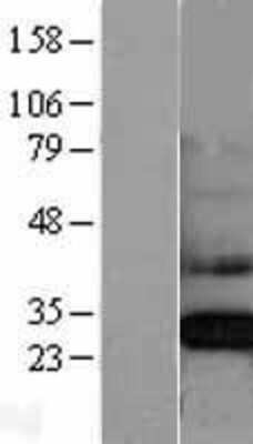 Western Blot: CLIC4 Overexpression Lysate (Adult Normal) [NBL1-09269] Left-Empty vector transfected control cell lysate (HEK293 cell lysate); Right -Over-expression Lysate for CLIC4.
