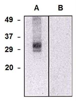 Western Blot: CLIC5 Antibody (CLIC5-02) [NBP2-62197] - Analysis of CLIC5a in HEK293-CLIC5a transfectants (A) and HEK293 cells (B) using mouse monoclonal antibody (clone CLIC5-02).