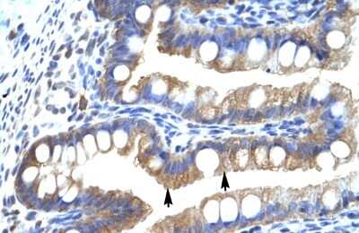 Immunohistochemistry-Paraffin: CLIC5 Antibody [NBP1-80075] - Human Intestine Tissue, antibody concentration 4-8ug/ml. Cells with positive label: Epithelial cells of intestinal villus (indicated with arrows) 400X magnification.