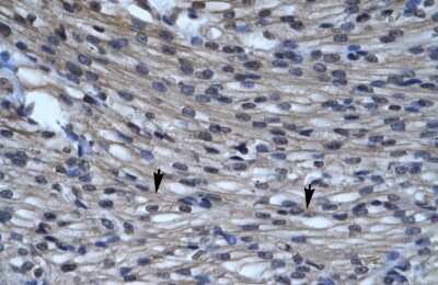 Immunohistochemistry-Paraffin: CLIC5 Antibody [NBP1-80076] - Human Heart Tissue, antibody concentration 4-8ug/ml. Cells with positive label: Myocardial cells (indicated with arrows) 400X magnification.