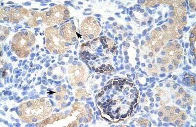 Immunohistochemistry-Paraffin: CLIC5 Antibody [NBP1-80077] - Human kidney Tissue, antibody concentration 4-8ug/ml. Cells with positive label: renal corpuscle cells (indicated with arrows) 400X magnification.