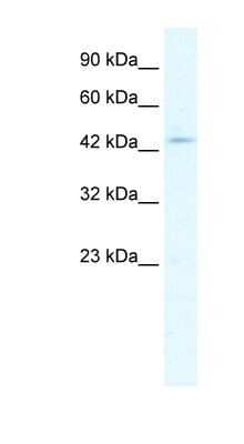 Western Blot CLIC5 Antibody - BSA Free