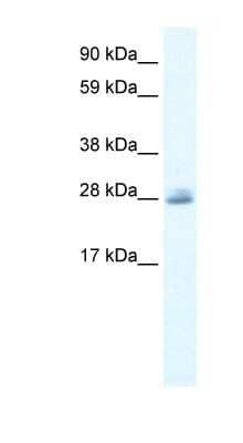 Western Blot CLIC5 Antibody - BSA Free