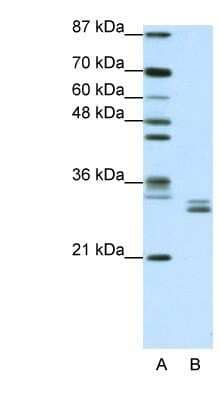 Western Blot: CLIC5 Antibody [NBP1-80077] - Jurkat cell lysate, concentration 1.25ug/ml.