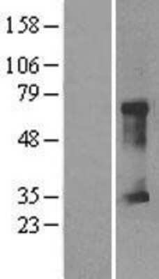 Western Blot: CLIC5 Overexpression Lysate (Adult Normal) [NBL1-09270] Left-Empty vector transfected control cell lysate (HEK293 cell lysate); Right -Over-expression Lysate for CLIC5.