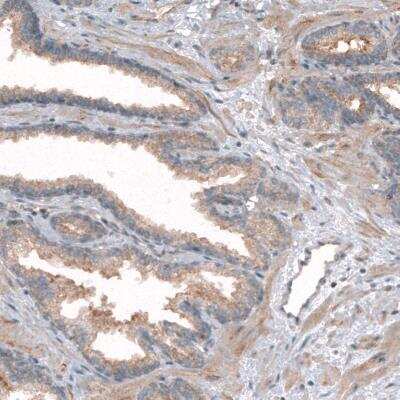 Immunohistochemistry-Paraffin: CLIP170 Antibody (CL4844) [NBP2-61143] - staining of human prostate shows weak cytoplasmic positivity in glandular and smooth muscle cells.