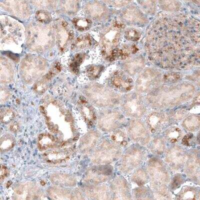 Immunohistochemistry-Paraffin: CLIP170 Antibody (CL4844) [NBP2-61143] - staining of human kidney shows moderate cytoplasmic immunoreactivity in a subset of renal tubules.