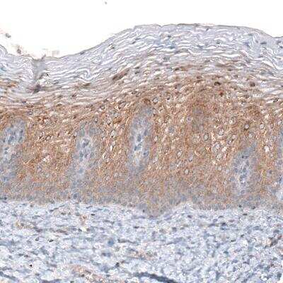 Immunohistochemistry-Paraffin: CLIP170 Antibody (CL4844) [NBP2-61143] - staining of human cervix shows moderate cytoplasmic positivity in squamous epithelial cells.