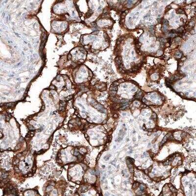 Immunohistochemistry-Paraffin: CLIP170 Antibody (CL4844) [NBP2-61143] - staining of human placenta shows strong cytoplasmic immunoreactivity in trophoblast.