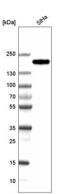 Western Blot: CLIP170 Antibody (CL4844) [NBP2-61143] - analysis in human cell line SiHa.