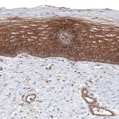 Immunohistochemistry-Paraffin: CLIP170 Antibody (CL4851) [NBP2-61144] - Staining of human cervix shows strong cytoplasmic positivity in squamous epithelial cells.