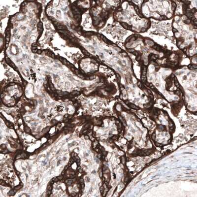 Immunohistochemistry-Paraffin: CLIP170 Antibody (CL4851) [NBP2-61144] - Staining of human placenta shows strong cytoplasmic immunoreactivity in trophoblast.