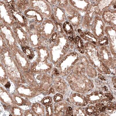 Immunohistochemistry-Paraffin: CLIP170 Antibody (CL4851) [NBP2-61144] - Staining of human kidney shows moderate to strong cytoplasmic immunoreactivity in renal tubules.