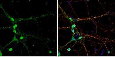 Immunocytochemistry/Immunofluorescence: CLIP170 Antibody [NBP2-15917] - DIV9 rat E18 primary cortical neuron cells were fixed in 4% paraformaldehyde at RT for 15 min. Green: CLIP170 stained by CLIP170 antibody [N1], N-term  diluted at 1:500. Red: alpha Tubulin, stained by alpha Tubulin antibody [114] diluted at 1:500.Blue: Fluoroshield with DAPI.