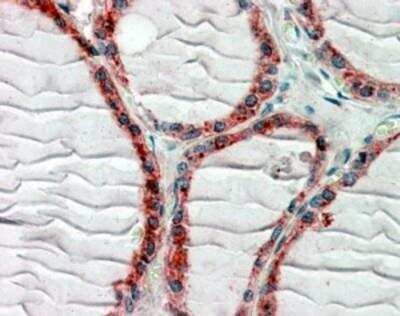 Immunohistochemistry-Paraffin: CLIP170 Antibody [NBP1-36749] - Staining of paraffin embedded Human Thyroid Gland. Antibody at 2.5 ug/mL. Steamed antigen retrieval with citrate buffer pH 6, AP-staining.