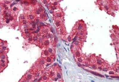 Immunohistochemistry-Paraffin: CLIP170 Antibody [NBP1-36749] - Staining of paraffin embedded Human Prostate. Antibody at 2.5 ug/mL. Steamed antigen retrieval with citrate buffer pH 6, AP-staining.