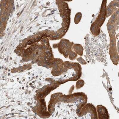 Immunohistochemistry-Paraffin: CLIP170 Antibody [NBP1-85568] - Staining of human placenta shows strong cytoplasmic positivity in trophoblastic cells.