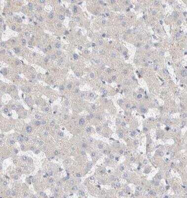 Immunohistochemistry-Paraffin: CLIP170 Antibody [NBP1-85568] - Staining of human liver shows negative positivity in hepatocytes as expected.