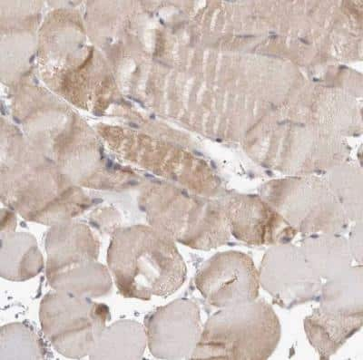 Immunohistochemistry-Paraffin: CLIP170 Antibody [NBP1-85568] - Staining of human skeletal muscle shows weak cytoplasmic positivity in myoctes.