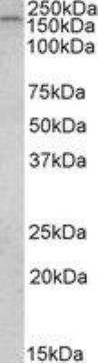 Western Blot CLIP170 Antibody