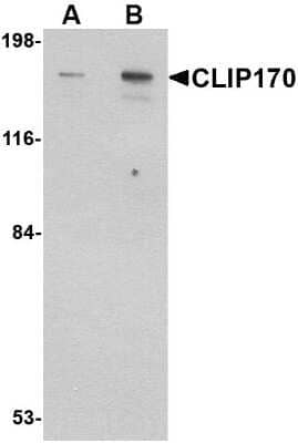 Western Blot: CLIP170 Antibody [NBP1-76921] - Rat brain tissue lysate with CLIP170 antibody at (A) 0.5 and (B) 1 ug/ml.