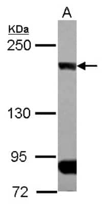 Western Blot: CLIP170 Antibody [NBP2-15917] - Sample (30 ug of whole cell lysate) A: A431 5% SDS PAGE gel, diluted at 1:1000.