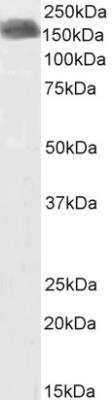 Western Blot: CLIP170 Antibody [NBP2-75095] - (1ug/ml) biotinylated staining of Human Breast Cancer lysate (35ug protein in RIPA buffer). Primary incubation was 1 hour. Detected by chemiluminescence, using streptavidin-HRP and using NAP blocker as a substitute for skimmed milk.