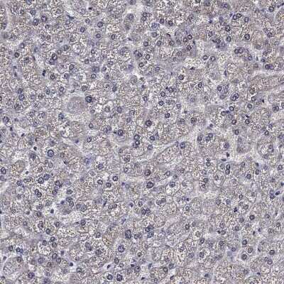 Immunohistochemistry-Paraffin: CLIP3 Antibody [NBP3-17101] - Staining of human liver shows low expression as expected.