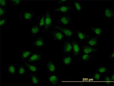 Immunocytochemistry/Immunofluorescence: CLK3 Antibody (7D6) [H00001198-M07] - Analysis of monoclonal antibody to CLK3 on HeLa cell. Antibody concentration 10 ug/ml