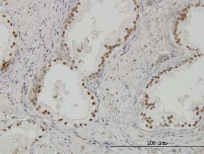 Immunohistochemistry-Paraffin: CLK3 Antibody (7D6) [H00001198-M07] - Analysis of monoclonal antibody to CLK3 on formalin-fixed paraffin-embedded human prostate. Antibody concentration 3 ug/ml