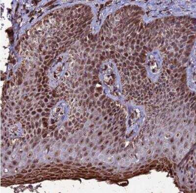 Immunohistochemistry-Paraffin: CLK3 Antibody [NBP1-91794] - Staining of human skin shows strong nuclear positivity in squamous epithelial cells.