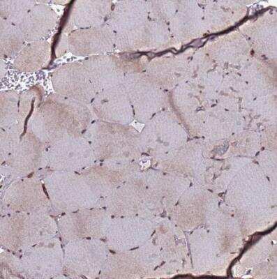 Immunohistochemistry-Paraffin: CLK3 Antibody [NBP1-91794] - Staining of human skeletal muscle shows moderate nuclear positivity in myocytes.