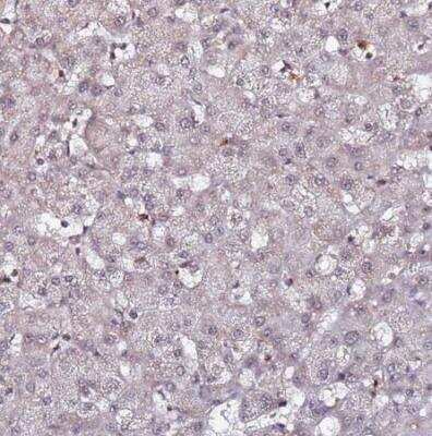 Immunohistochemistry-Paraffin: CLK3 Antibody [NBP1-91794] - Staining of human liver shows very weak positivity in hepatocytes as expected.