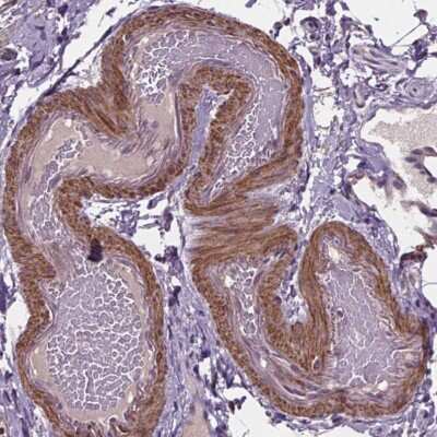 Immunohistochemistry: CLN3 Antibody [NBP2-49391] - Staining of human smooth muscle shows strong cytoplasmic positivity in smooth muscle cells.