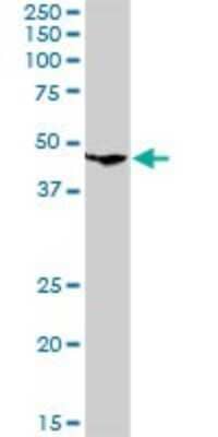 Western Blot: CLN3 Antibody [H00001201-D01P] - Analysis of CLN3 expression in mouse kidney.