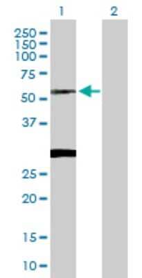 Western Blot: CLN3 Antibody [H00001201-D01P] - Analysis of CLN3 expression in transfected 293T cell line by CLN3 polyclonal antibody.Lane 1: CLN3 transfected lysate(47.60 KDa).Lane 2: Non-transfected lysate.