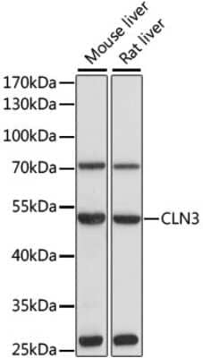 Western Blot: CLN3 Antibody [NBP2-92767] - Analysis of extracts of various cell lines, using CLN3 at 1:1000 dilution.Secondary antibody: HRP Goat Anti-Rabbit IgG (H+L) at 1:10000 dilution.Lysates/proteins: 25ug per lane.Blocking buffer: 3% nonfat dry milk in TBST.Detection: ECL Basic Kit .Exposure time: 30s.