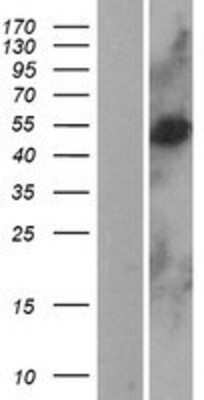 Western Blot: CLN3 Overexpression Lysate (Adult Normal) [NBP2-04147] Left-Empty vector transfected control cell lysate (HEK293 cell lysate); Right -Over-expression Lysate for CLN3.