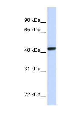 Western Blot CLN8 Antibody