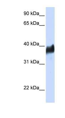 Western Blot CLN8 Antibody