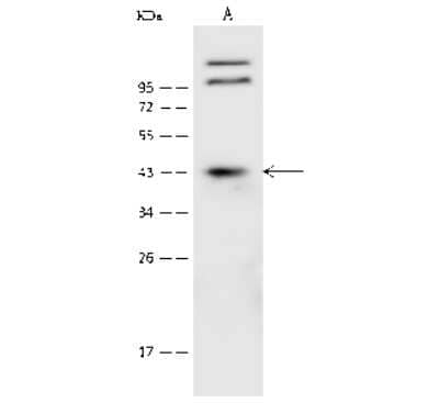 Western Blot: CLN8 Antibody [NBP2-99467] - Anti-CLN8 rabbit polyclonal antibody at 1:500 dilution. Lane A: HeLa Whole Cell Lysate Lysates/proteins at 30 ug per lane. Secondary Goat Anti-Rabbit IgG (H+L)/HRP at 1/10000 dilution. Developed using the ECL technique. Performed under reducing conditions. Predicted band size: 33 kDa. Observed band size: 43 kDa (We are unsure as to the identity of these extra bands).