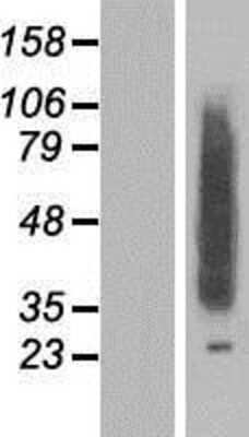 Western Blot CLN8 Overexpression Lysate