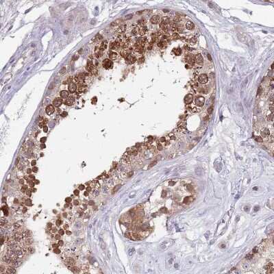Immunohistochemistry-Paraffin: CLNS1A Antibody [NBP2-33964] - Staining of human testis shows strong cytoplasmic positivity in cells in seminiferus ducts.