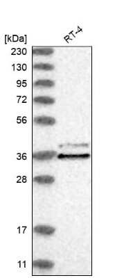 Western Blot: CLNS1A Antibody [NBP2-33959] - Analysis in human cell line RT-4.