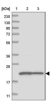 Western Blot CLNS1A Antibody