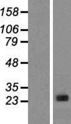 Western Blot CLNS1A Overexpression Lysate